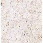 Anti-GFAP Rabbit pAb (100 μl)