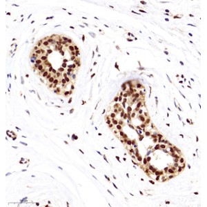 Anti-HMGB1 Rabbit pAb (100 μl)