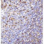 Anti-IL-1 beta Rabbit pAb (100 μl)