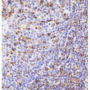 Anti-IL-1 beta Rabbit pAb (100 μl)