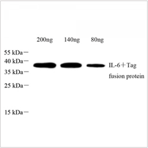 Anti-IL-6 Rabbit pAb (100 μl)