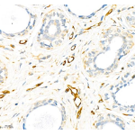 Anti-Vimentin Rabbit pAb (100 μl)