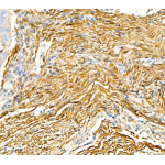 Anti-alpha smooth muscle Actin Rabbit pAb (100 μl)