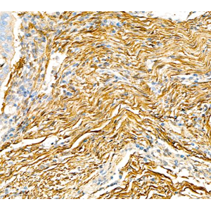 Anti-alpha smooth muscle Actin Rabbit pAb (100 μl)
