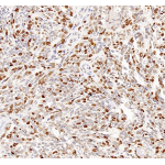 Anti-Ki67 Rabbit pAb (100 μl)