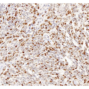 Anti-Ki67 Rabbit pAb (100 μl)
