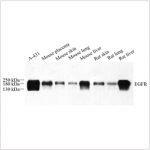 Anti-EGFR Rabbit pAb (100 μl)