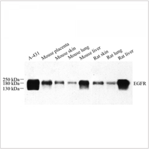 Anti-EGFR Rabbit pAb (100 μl)