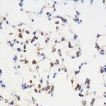 Anti-TGF beta 1 Rabbit pAb (100 μl)