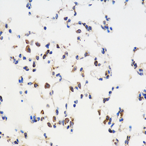 Anti-TGF beta 1 Rabbit pAb (100 μl)