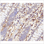 Anti-Vimentin Rabbit pAb (100 μl)