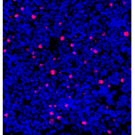 Anti-FOXP3 Rabbit pAb (100 μl)