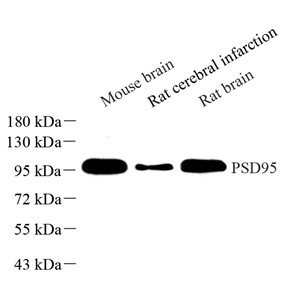 Anti-PSD95 Rabbit pAb (100 μl)
