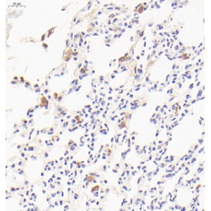 Anti-MRC1 Rabbit pAb (100 μl)