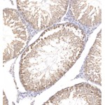 Anti-NRF2 Rabbit pAb (100 μl)