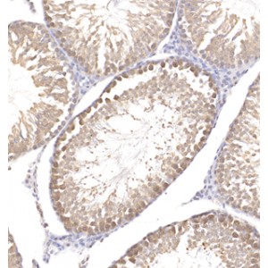 Anti-NRF2 Rabbit pAb (100 μl)