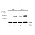 Anti-Phospho-NF-kB p65 (S536) Rabbit pAb (100 μl)