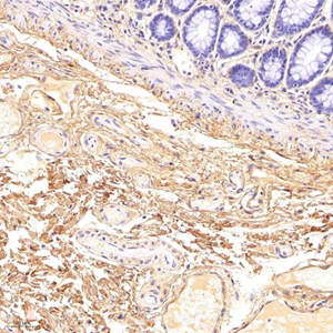 Anti-Collagen I Rabbit pAb (100 μl)