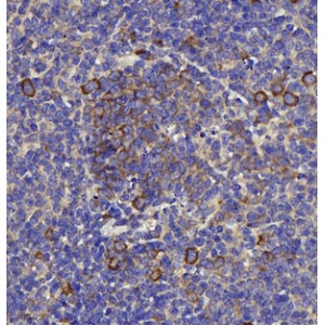 Anti-TLR4 Rabbit pAb (100 μl)