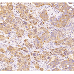 Anti-SQSTM1 / p62 Rabbit pAb (100 μl)