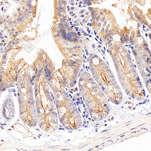Anti-ZO1 tight junction protein Rabbit pAb (100 μl)