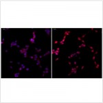 Anti-NF-kB p65 Rabbit pAb (100 μl)