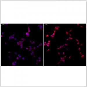 Anti-NF-kB p65 Rabbit pAb (100 μl)