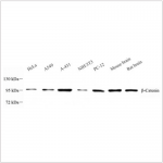 Anti-beta Catenin Mouse mAb (100 μl)