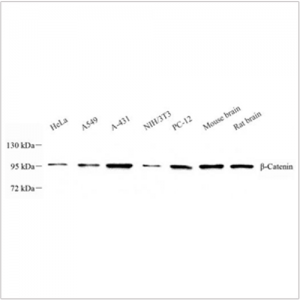 Anti-beta Catenin Mouse mAb (100 μl)