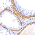 Anti-alpha smooth muscle Actin Mouse mAb (100 μl)