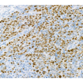 Anti-Ki67 Mouse mAb (100 μl)