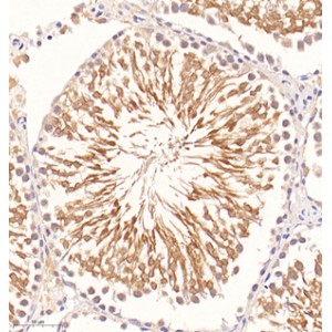 Anti-Glutathione Peroxidase 4 Mouse mAb (100 μl)