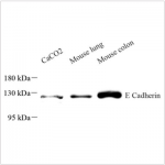 Anti-E Cadherin Mouse mAb (100 μl)