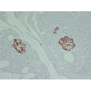 Anti-TIMP1 Mouse mAb (50 μl)