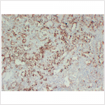 Anti-TPO Mouse mAb (50 μl)