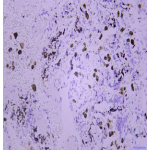 Anti-ACP5 Mouse mAb (50 μl)