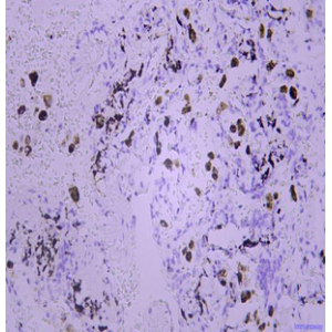 Anti-ACP5 Mouse mAb (50 μl)