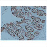 Anti-Villin Mouse mAb (50 μl)