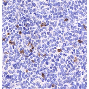 Recombinant Anti-CD4 Rabbit mAb (100 μl)