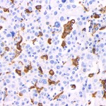 Recombinant Anti-Iba1 Mouse mAb (100 μl)