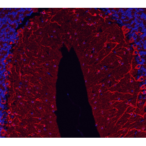 Recombinant Anti-beta III Tubulin Mouse mAb (100 μl)