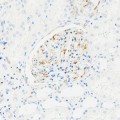 Recombinant Anti-VEGFA Rabbit mAb (100 μl)