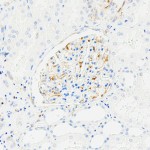 Recombinant Anti-VEGFA Rabbit mAb (100 μl)