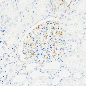 Recombinant Anti-VEGFA Rabbit mAb (100 μl)