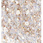 Recombinant Anti-Bax Rabbit mAb (100 μl)