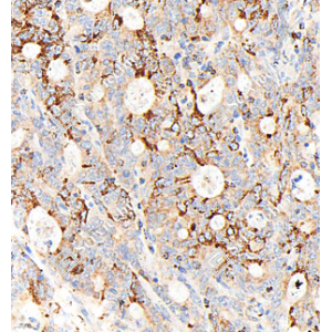 Recombinant Anti-Bax Rabbit mAb (100 μl)