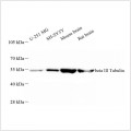 Recombinant Anti-beta III Tubulin antibody (HRP Conjugated)  (100 μl)