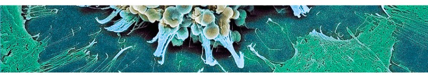 FadeStop™ Fluorescent Mounting Medium