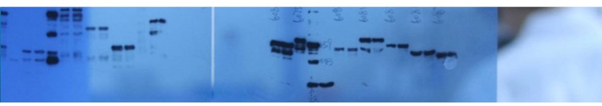 SuperECL WB Detection Kits