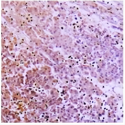 collagen-pan antibody